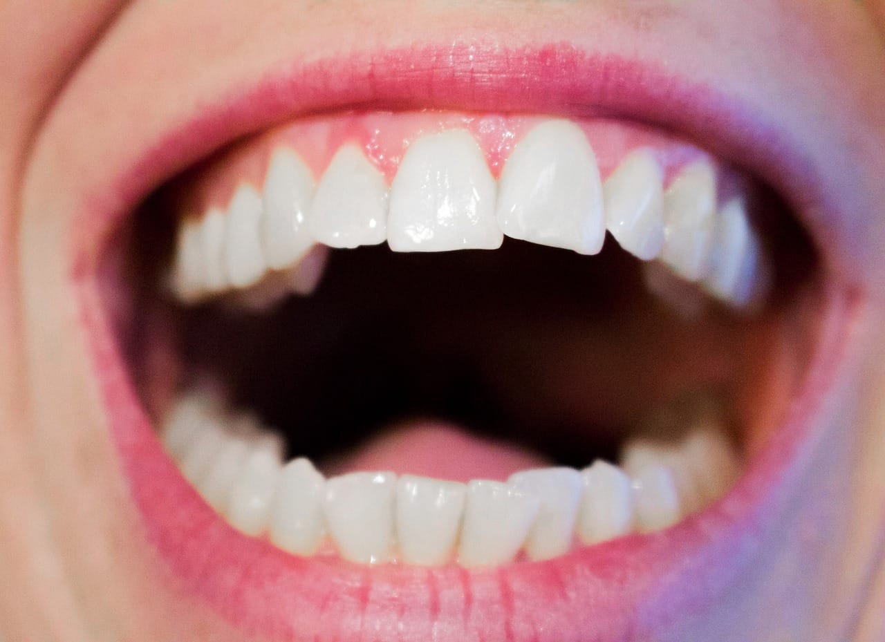 dental care
